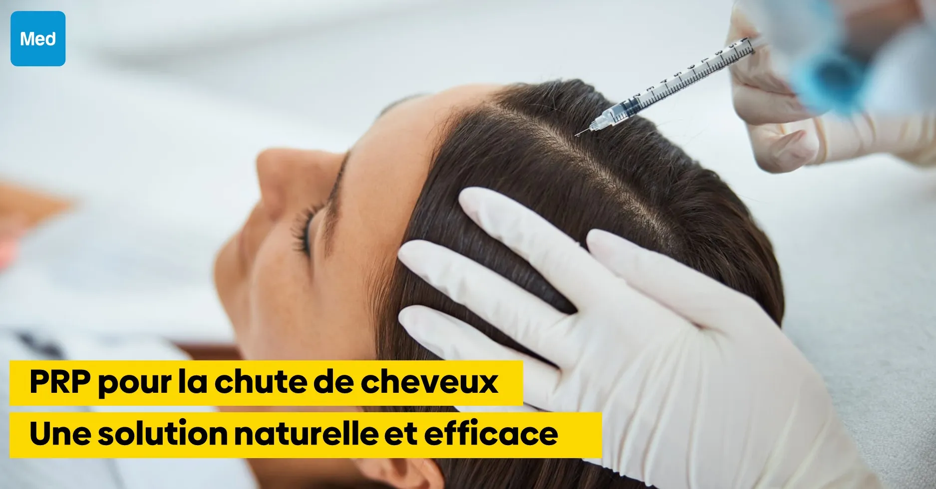 PRP pour la chute de cheveux : Une solution naturelle et efficace